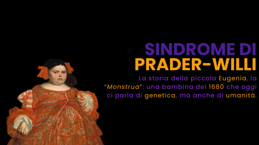 Sindrome di Prader-Willi